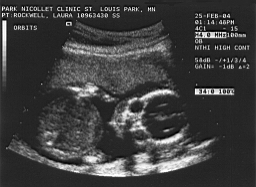baby1.jpg