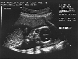 baby2.jpg