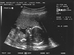 baby3.jpg