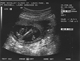 baby4.jpg
