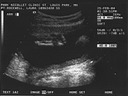 baby6.jpg